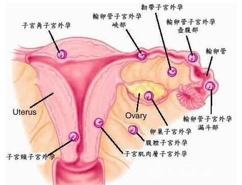 铜川新城解答:为什么会患上宫颈息肉